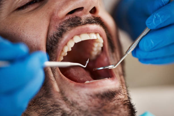 Best Emergency Gum Pain Relief  in Chenango Bridge, NY